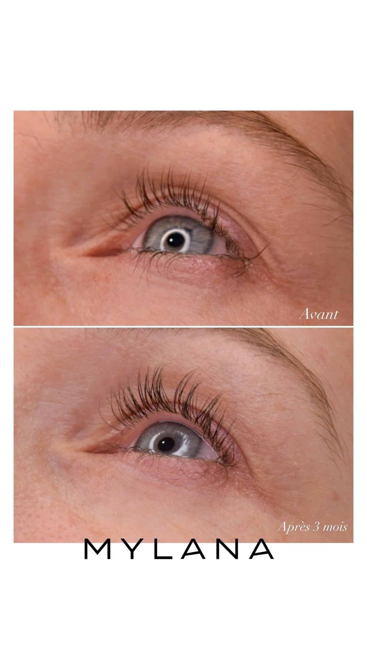 Sérum de croissance pour cils et sourcils Mylana