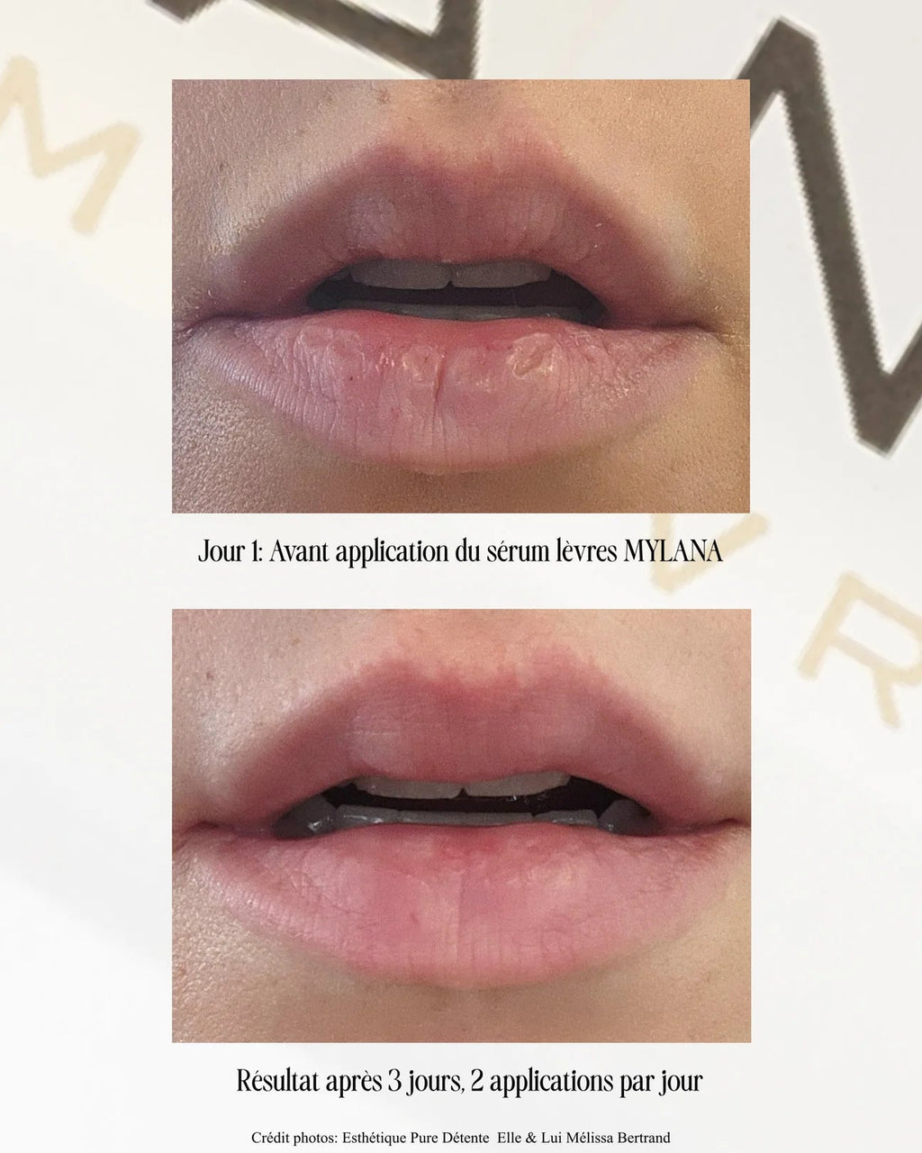 Sérum pour les lèvres Mylana